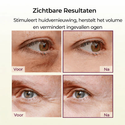 Calciderm™ | Volume Herstel Balsem