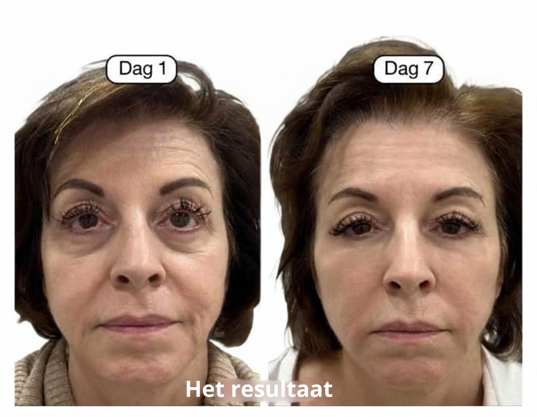 GlowLift Brush™ | Zeg vaarwel tegen een opgezwollen gezicht
