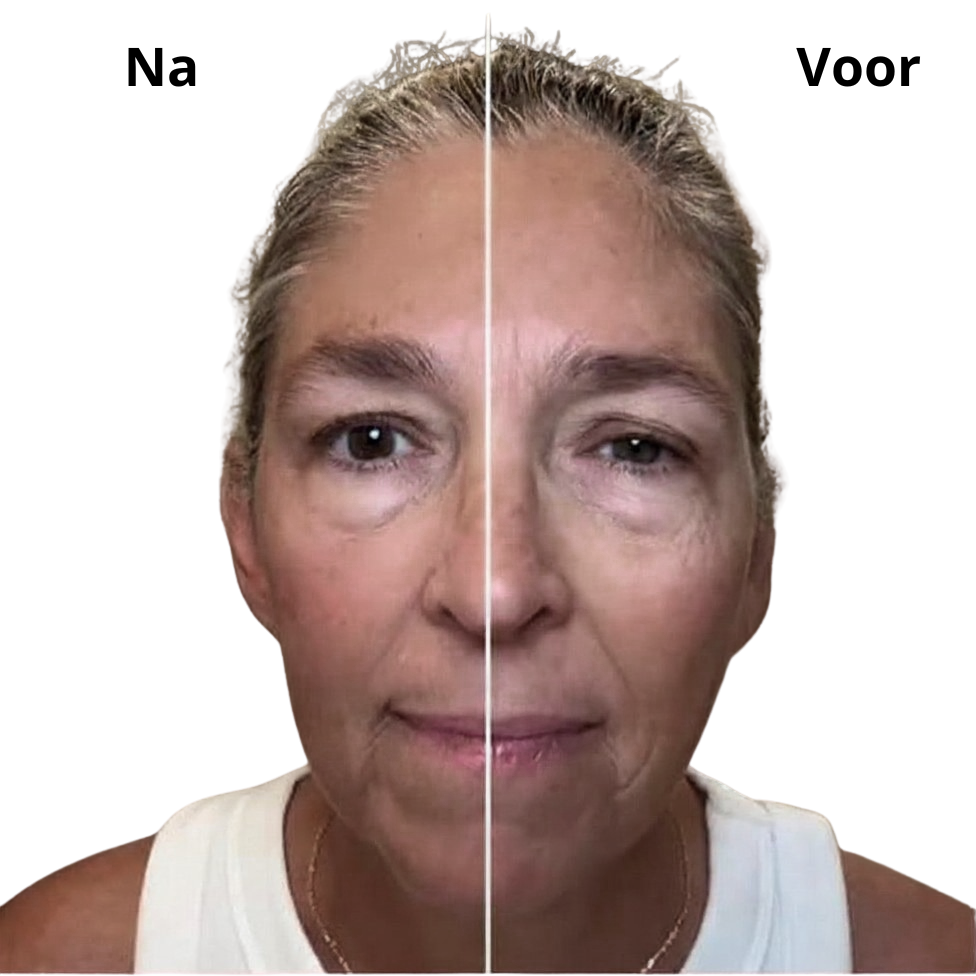 GlowLift Brush™ | Zeg vaarwel tegen een opgezwollen gezicht